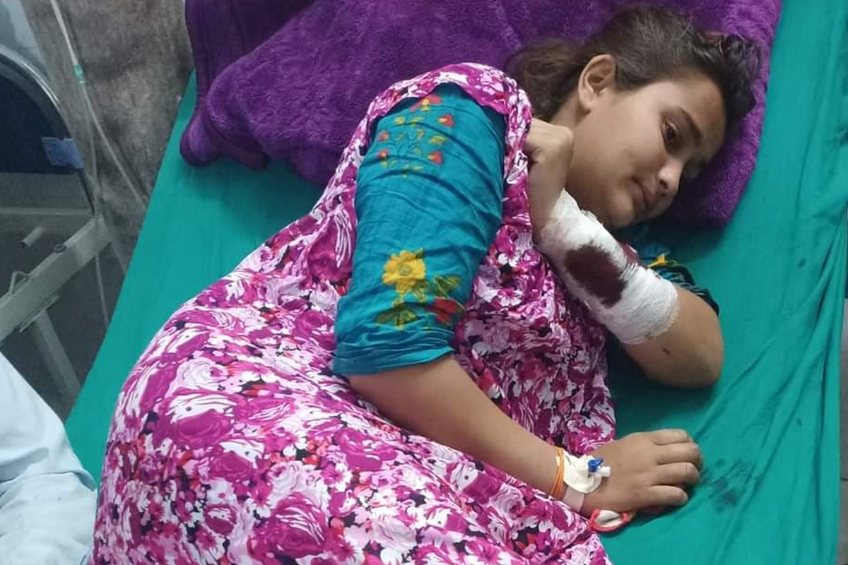 बँदेलको आक्रमणमा परी कञ्चनपुरमा पाँच जना घाइते