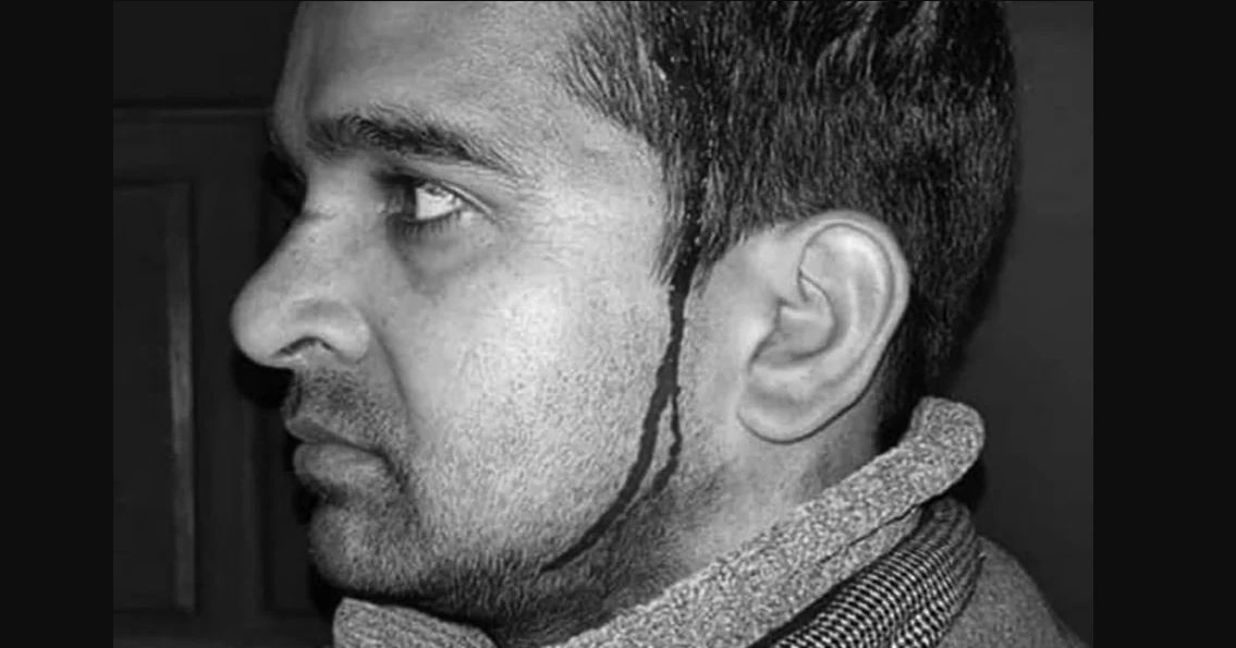 बेरुजु नमिलाइदिएको भन्दै वडाध्यक्षले चेनले कुटे अधिकृत