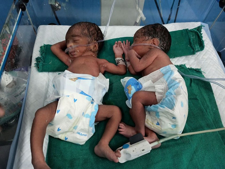 २६ वर्षीया महिलाले जन्माइन् चम्ल्याहा शिशु