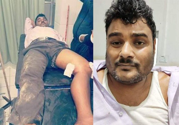 सर्वाधिक खोजीमा रहेका पटेल पक्राउ, प्रहरीको जवाफी कारवाहीमा घाइते