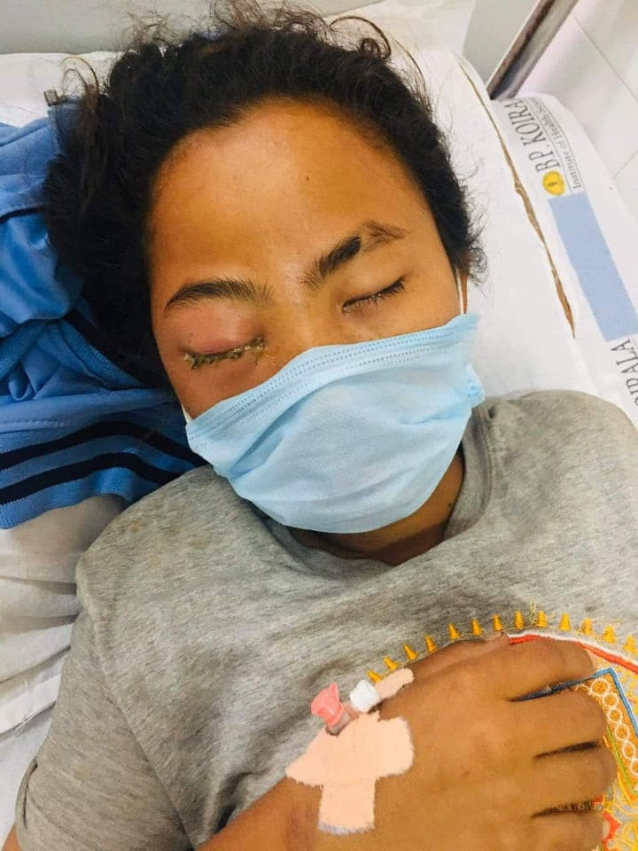 एन्फाले फुटबलर समीक्षाको आँखा उपचार खर्च व्यहोर्ने