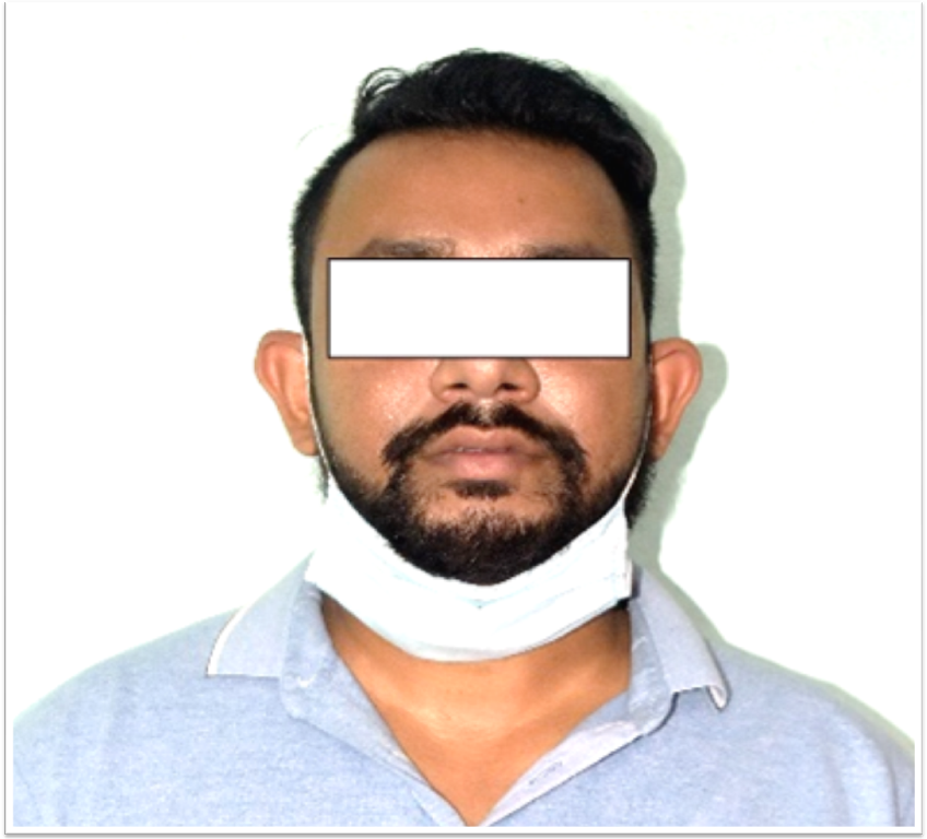 विश्व स्वास्थ्य संगठनमा जागिर लगाइदिने भन्दै ठगी गरेको आरोपमा युवक पक्राउ