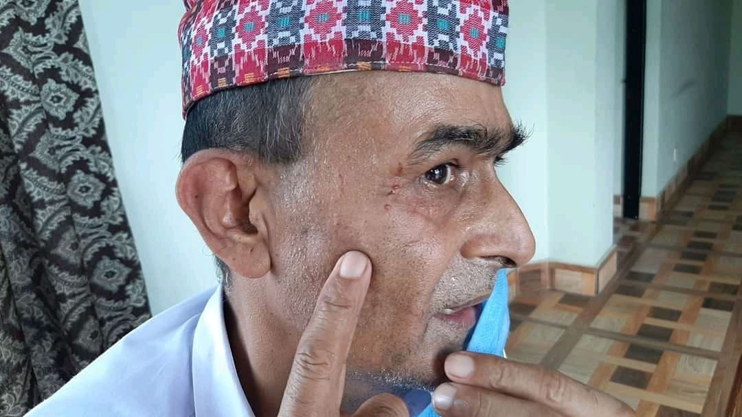 श्रम अधिकृत प्रेम सञ्जेलमाथि कुटपिट गर्नेलाई अभद्र व्यवहारको मुद्दा