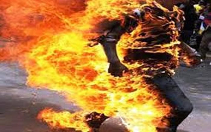 क्वारेन्टिनमा गार्ड बसेका युवाले आफैमाथि आगो लगाए