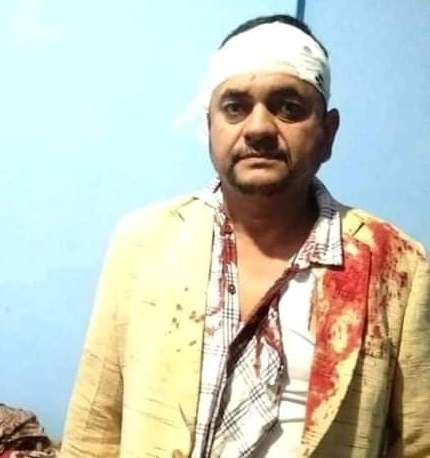 केन्द्रबारे विवादमा गाउँपालिका अध्यक्षमाथि हातपात, झडपमा  १४ जना घाइते