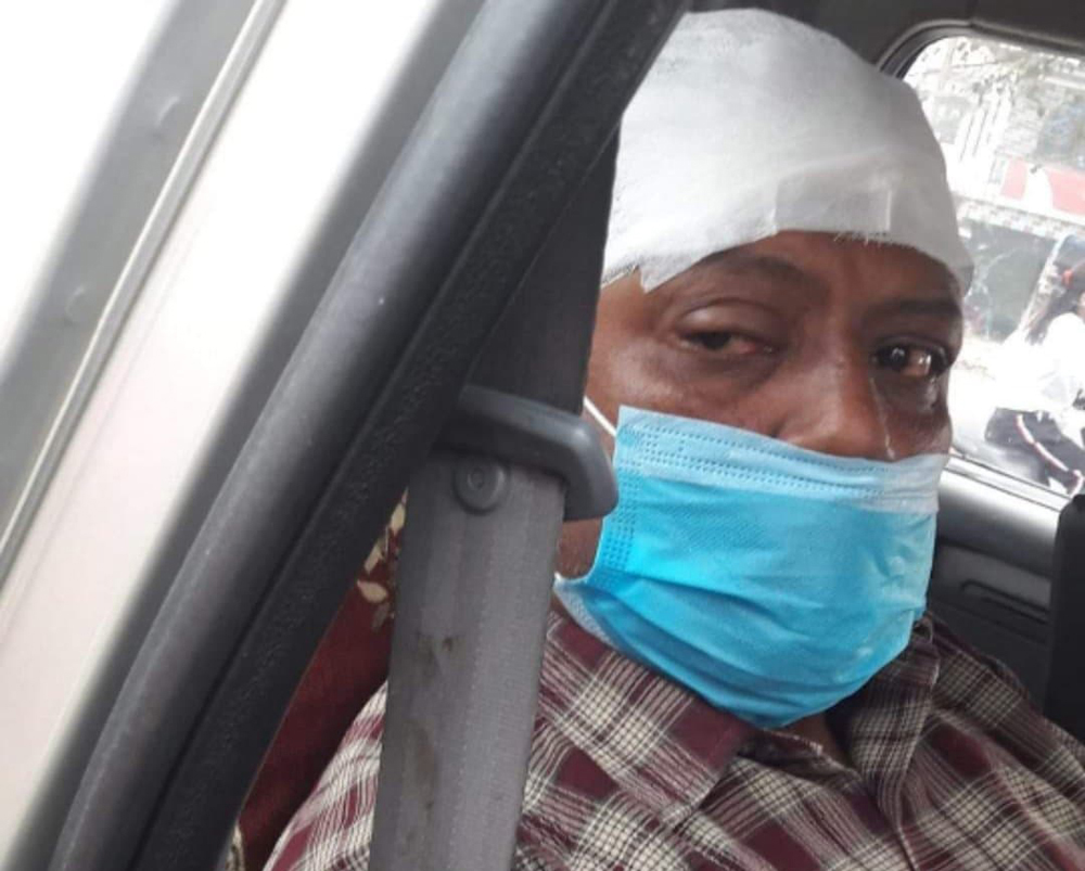 विद्यार्थीको कुटपिटबाट प्रधानाध्यापक घाइते