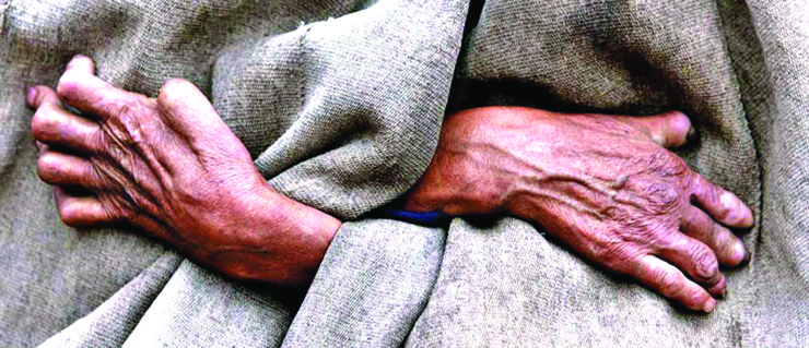 वर्षदिनमा १८ सयभन्दा बढी कुष्ठरोगी थपिए 