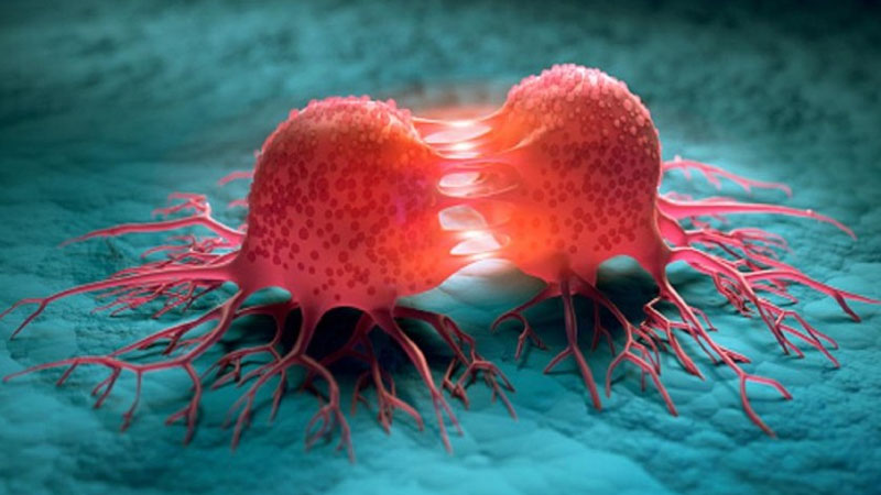 यस्ता लक्षण देखिए हुनसक्छ 'बोन क्यान्सर'