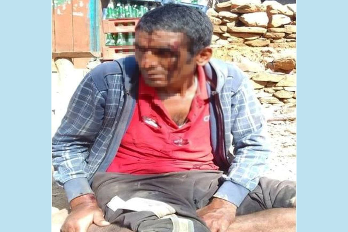 डडेल्धुरामा घाइते अवस्थामा एक पुरुष फेला