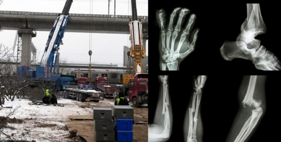 चीनमा दुई रेल ठोक्किँदा १०२ जनाको हड्डी भाँच्चियो