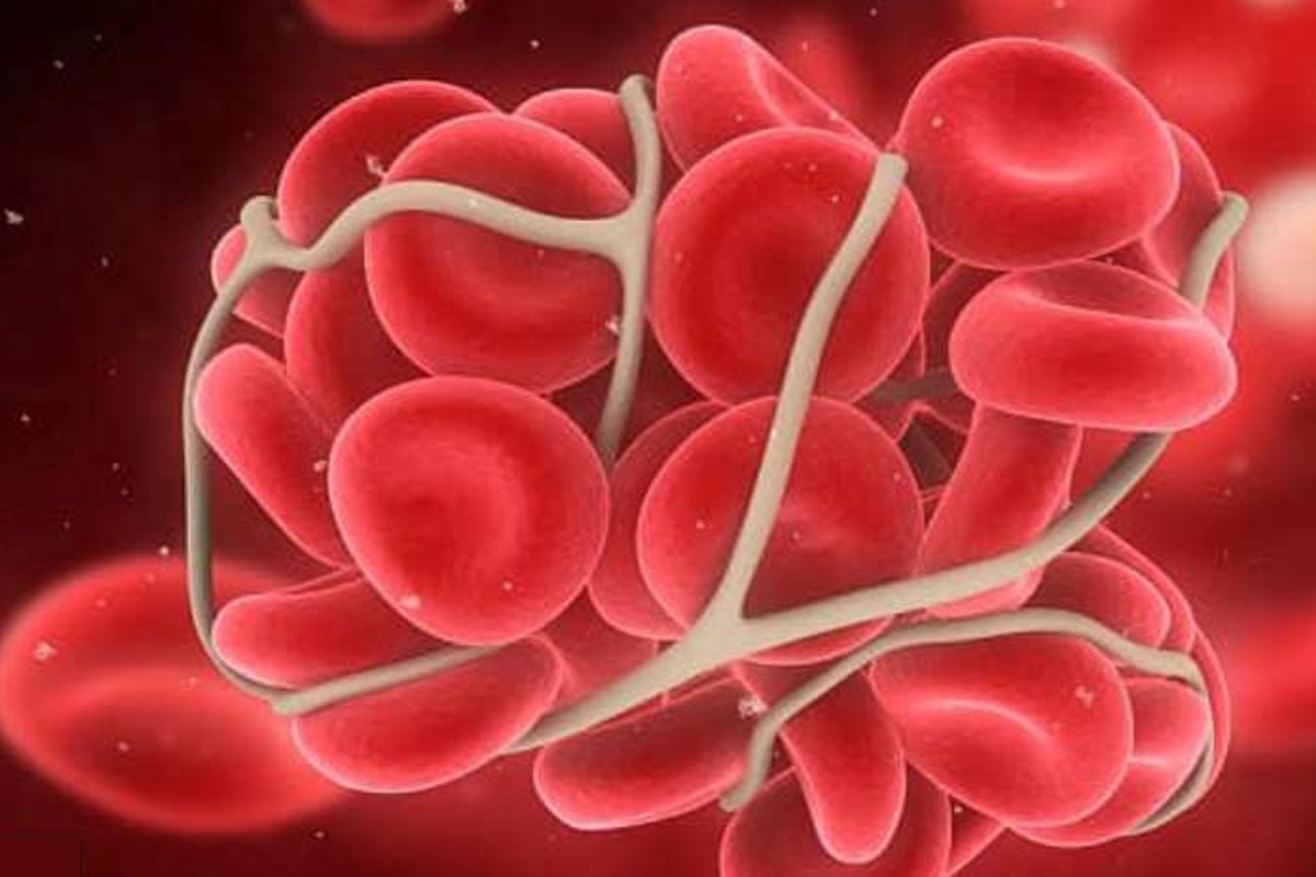 क्यान्सरका ७३ प्रतिशत बिरामीको रोग धेरै ढिला पहिचान हुने