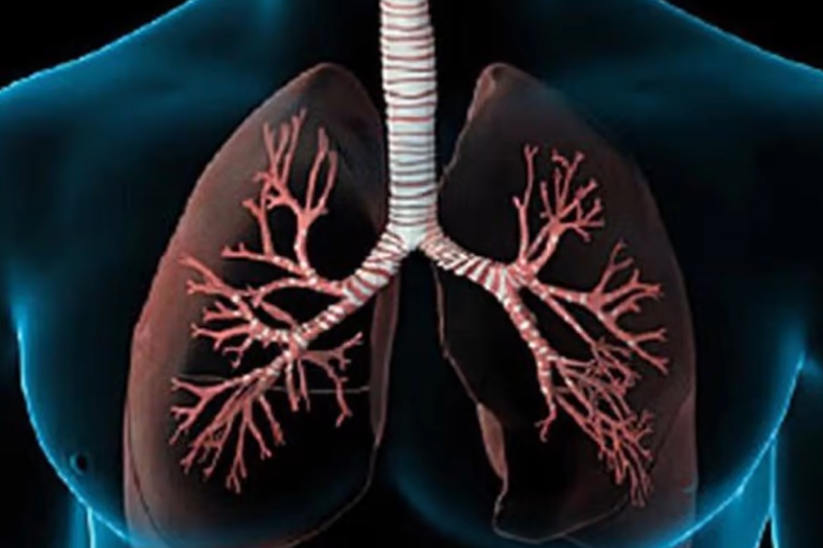 फोक्सोलाई स्वस्थ कसरी राख्‍ने?