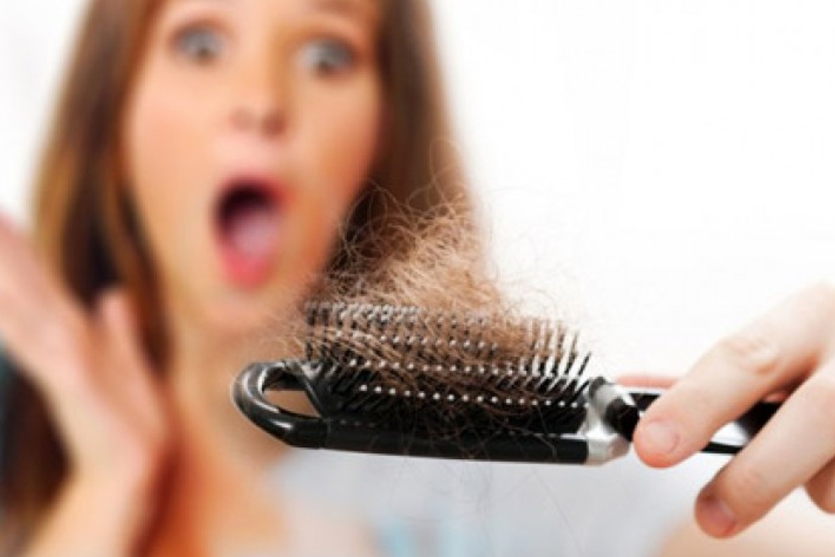 कपाल झर्ने समस्याबाट छुटकारा पाउन के गर्ने?