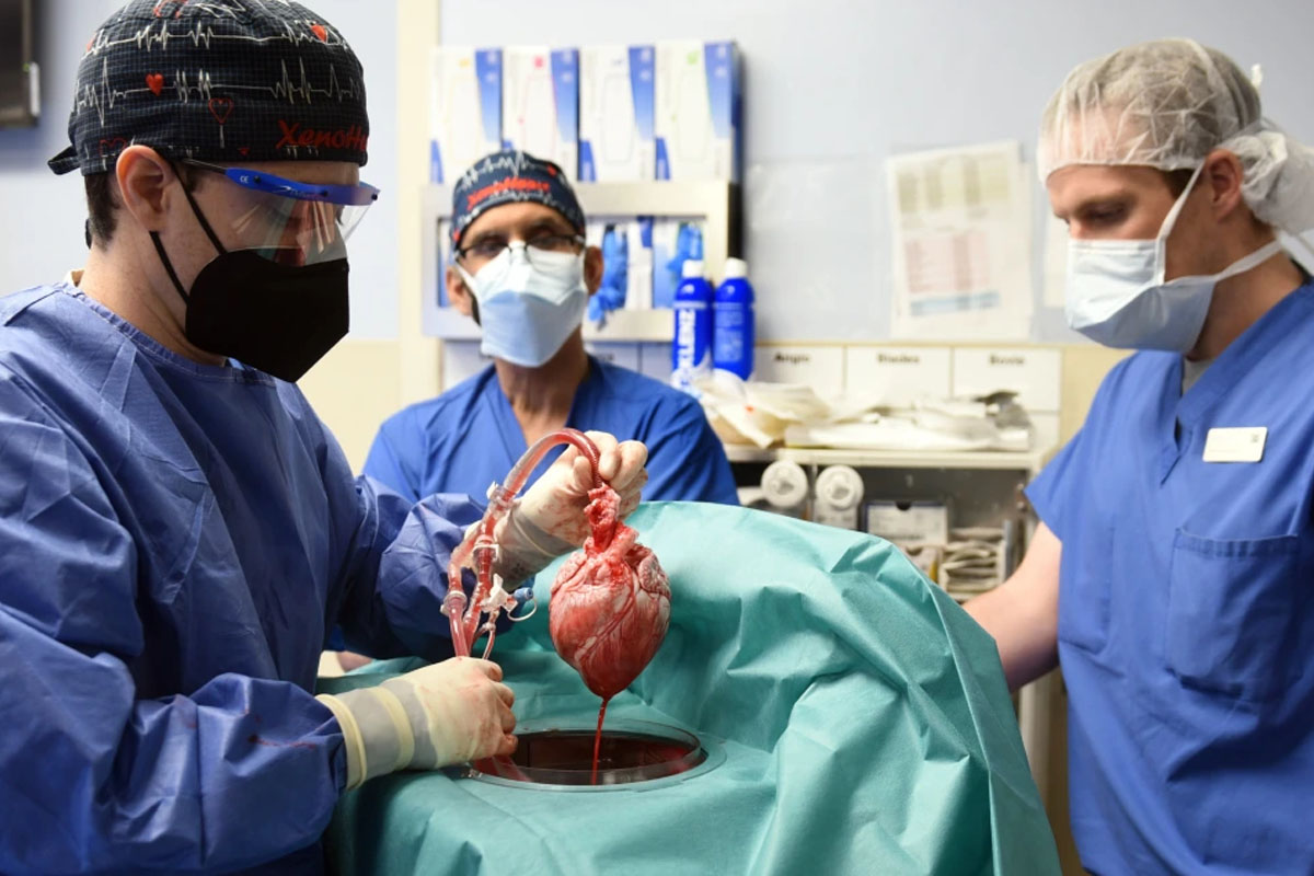 भिड बेनेटलाई दिइएको सुँगुरको मुटु नै संक्रमित भएको पुष्टि