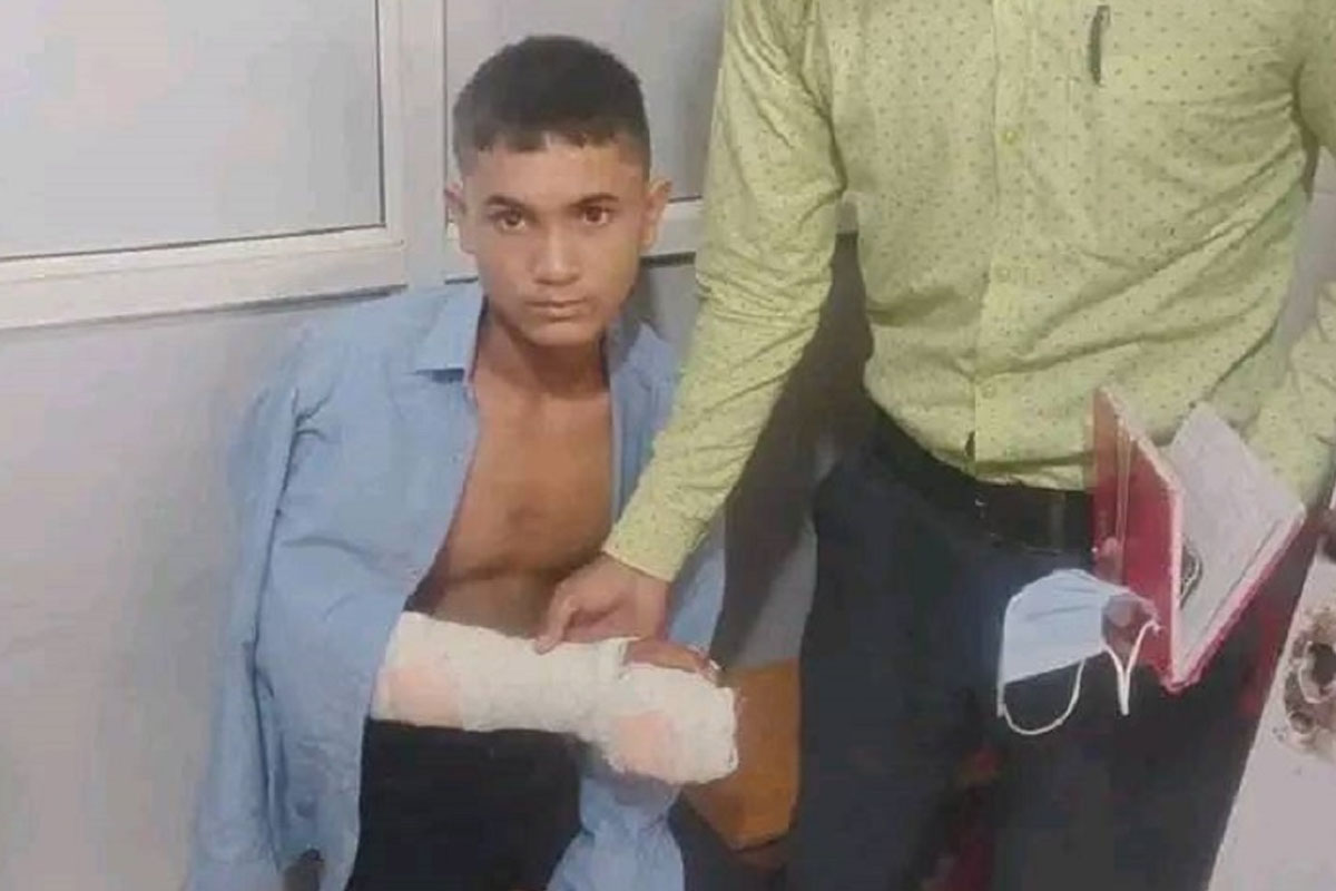 शिक्षकले हातै भाँचिने गरी विद्यार्थी कुटेपछि...