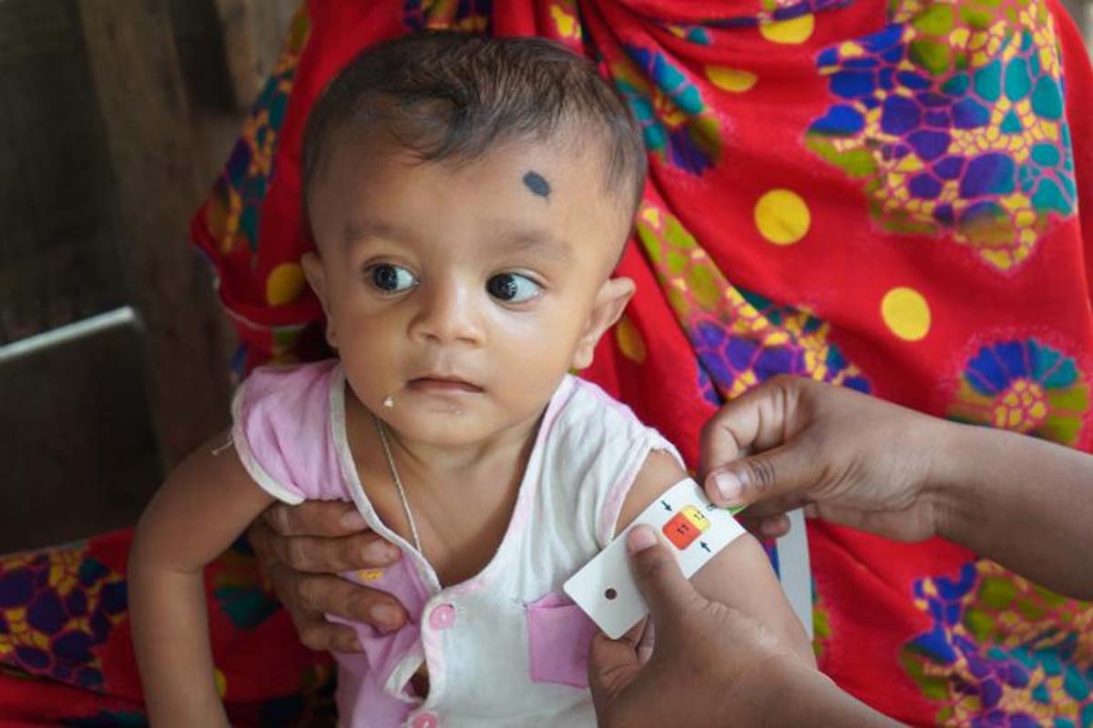 गरिबी र कुपोषणको थप मारमा पर्दै नेपाली बालबालिका : युनिसेफ