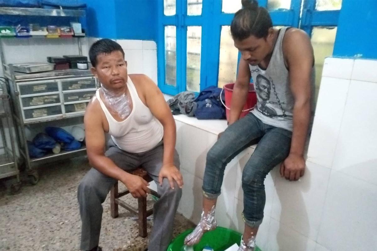 गुडिरहेको बसमा एसिड पोखिँदा ५ जना घाइते