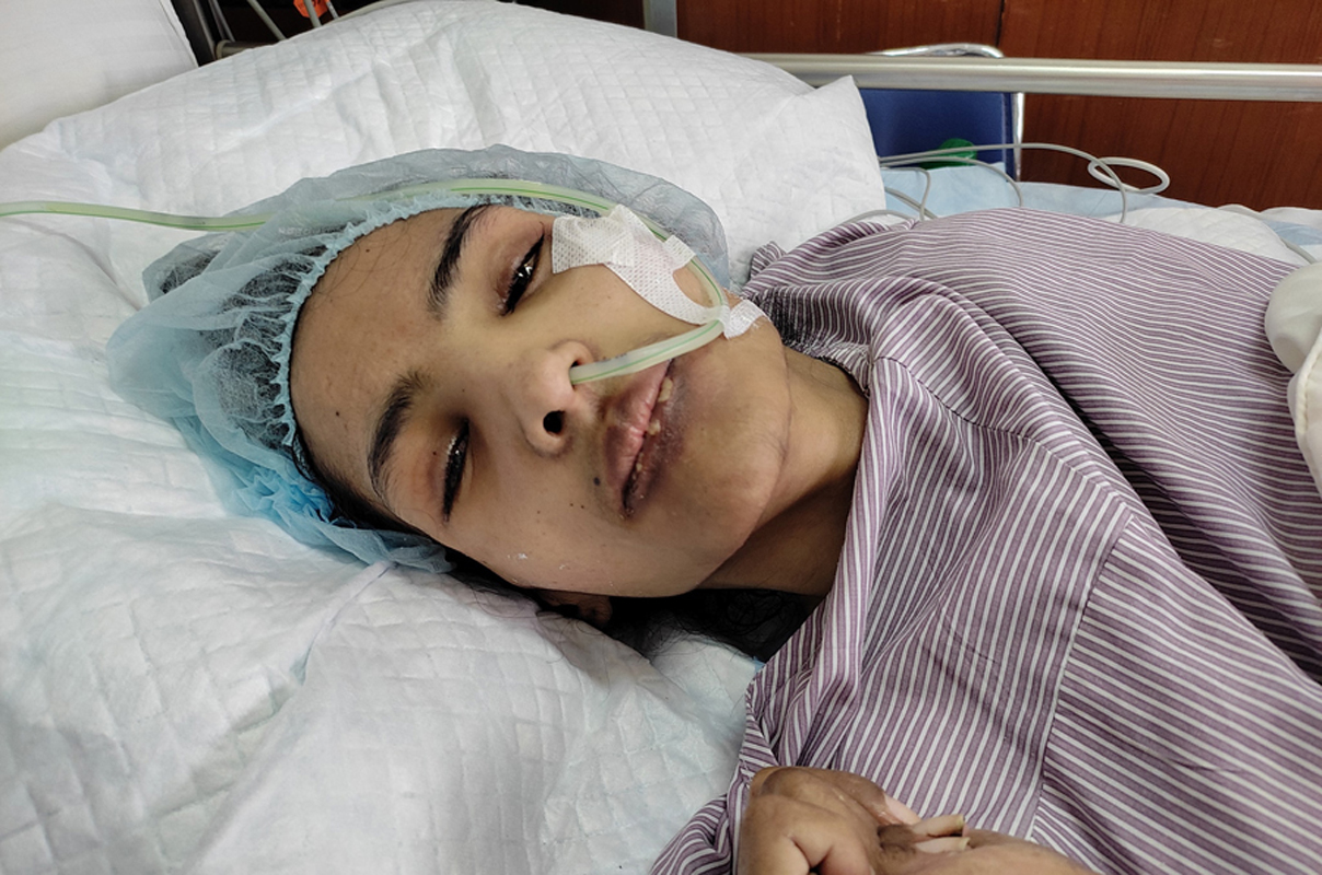 मोडल निशा घिमिरेको स्वास्थ्य तीन महिनामा पनि उस्तै, नर्भिकले भन्यो– पूर्ण रूपमा सामान्य हुन सम्भव छैन