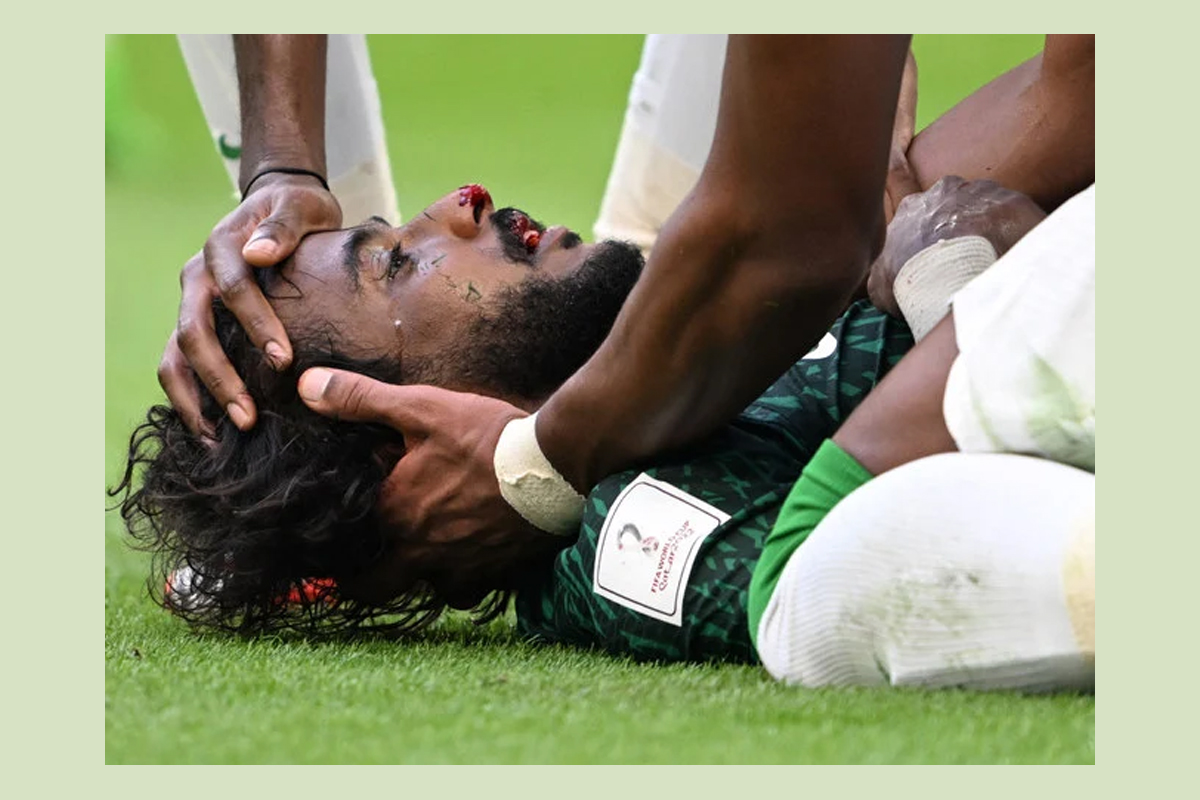 आफ्नै गोलकिपरसँग ठोक्किएका साउदी खेलाडीको स्वदेश लगेर उपचार