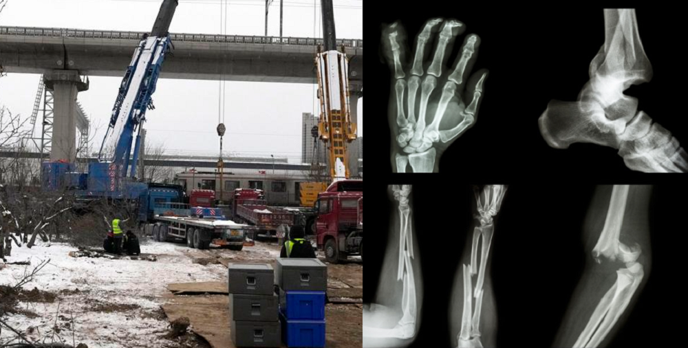 चीनमा दुई रेल ठोक्किँदा १०२ जनाको हड्डी भाँच्चियो