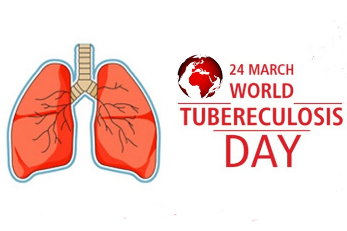 आज विश्व क्षयरोग दिवस : लागूपदार्थको दुर्व्यससनले क्षयरोगको विश्वव्यापी महामारी